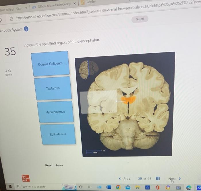 solved-indicate-the-specified-region-of-the-diencephalon-chegg