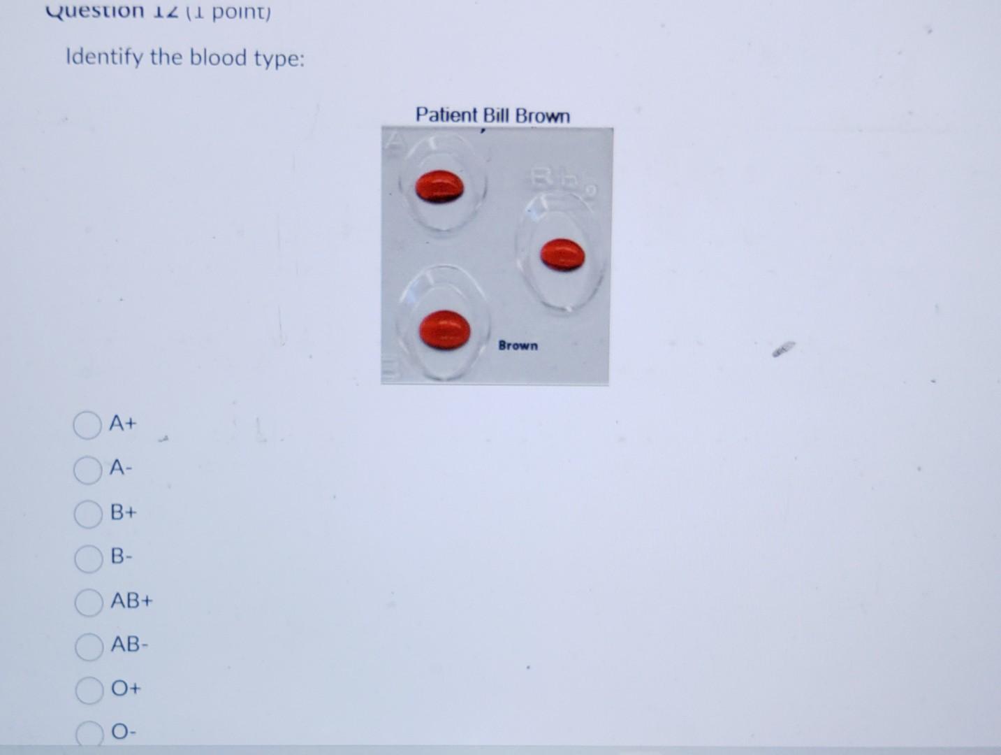 solved-review-of-blood-typing-terminology-red-blood-cells-chegg