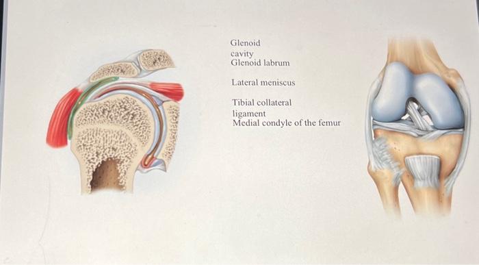 Solved Glenoid Cavity Glenoid Labrum Lateral Meniscus Tibial 