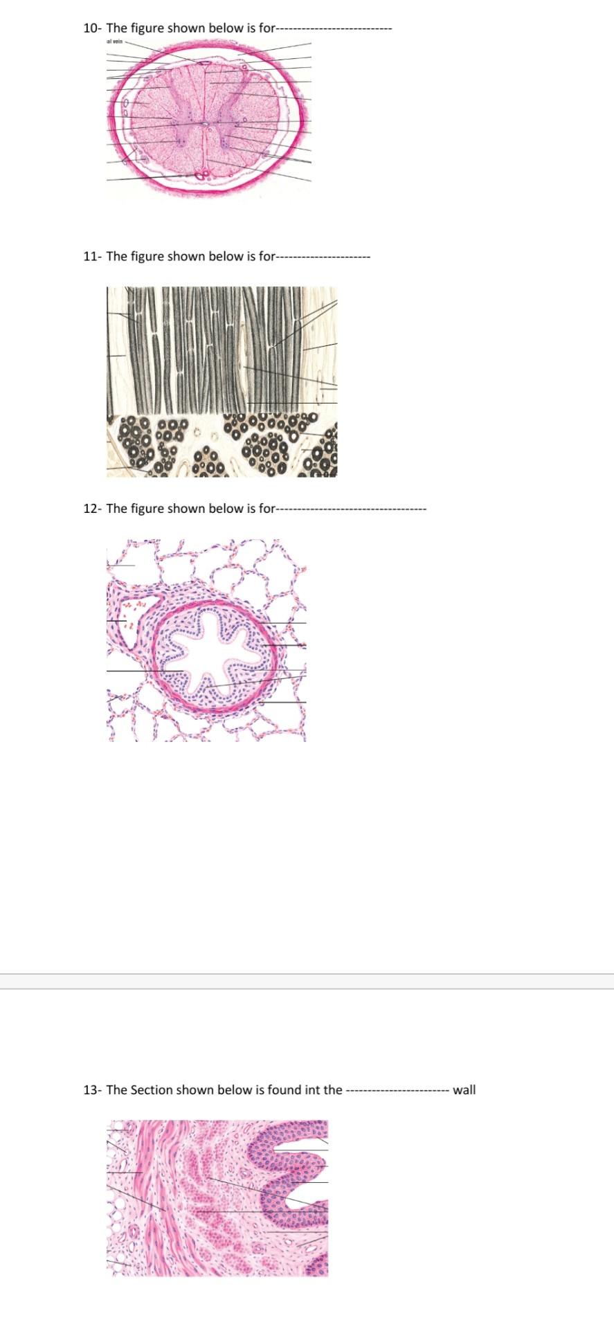 Solved 10- The figure shown below is for-- 11- The figure | Chegg.com