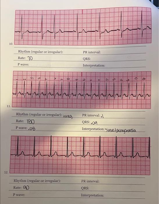 Solved 1 10. PR interval: Rhythm (regular or irregular): | Chegg.com