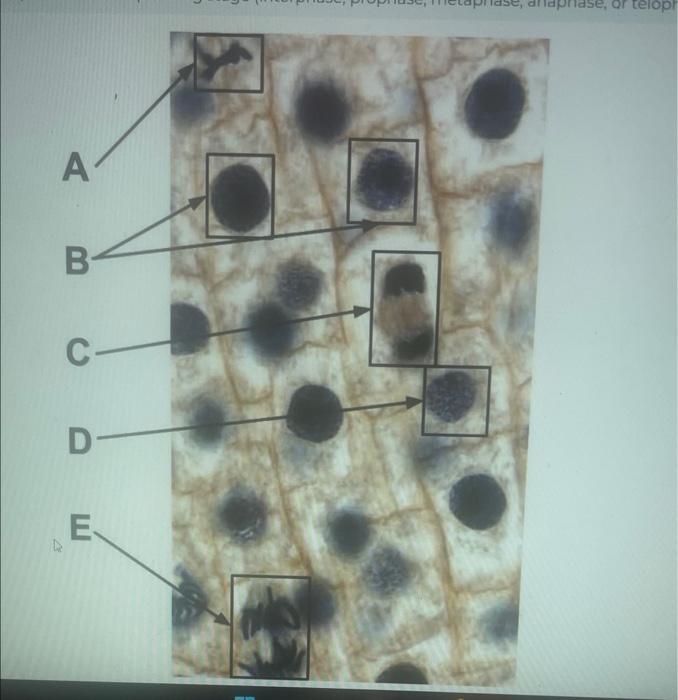 Solved Count up the number of cells in each stage/phase. | Chegg.com
