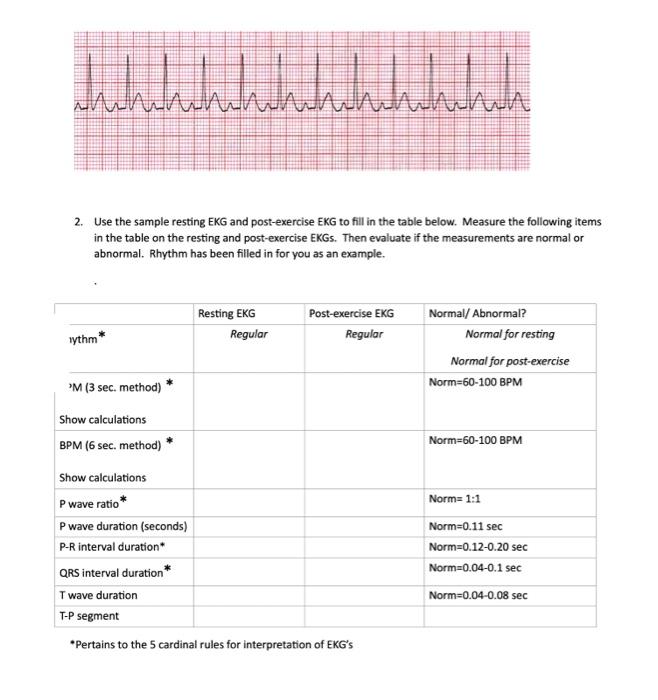 Ekg Practice Worksheet For Nurses