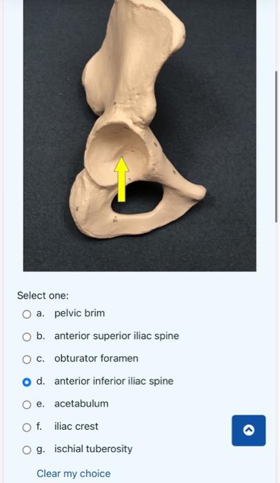 Select one:
O a.
O b.
O c.
O d.
O e.
O f.
O g.
pelvic brim
anterior superior iliac spine
obturator foramen
anterior inferior 