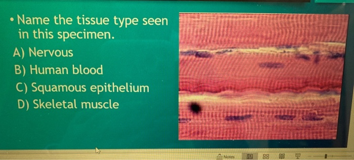 Solved Name The Tissue Type Seen In This Specimen A N Chegg Com