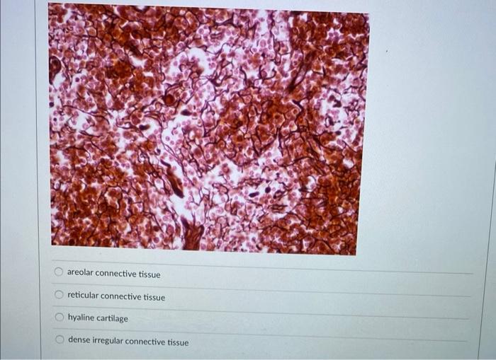 Solved Areolar Connective Tissue Reticular Connective Tissue 9812