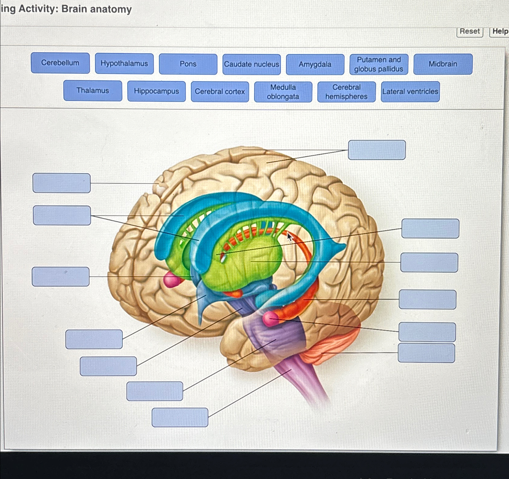 Solved ing Activity: Brain anatomyResetHelpPutamen andglobus | Chegg.com
