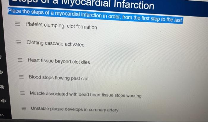 Place the steps of a myocardial infarction in order, from the first step to the last.
\( \equiv \) Platelet clumping, clot fo