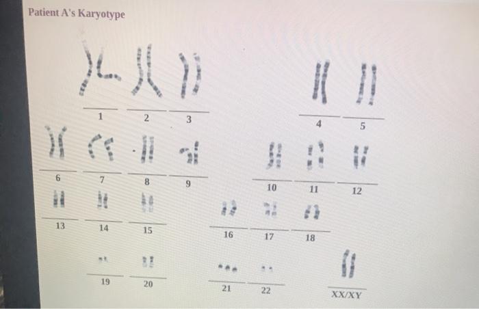 Solved Interpreting the karyotype Lab technicians compile | Chegg.com