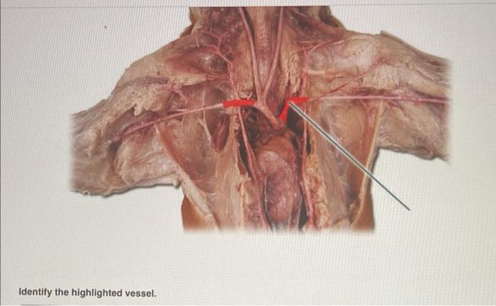 Identify the highlighted vessel.