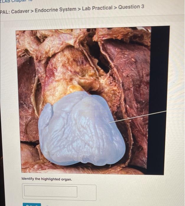 Solved Pal Cadaver Endocrine System Lab Practical Chegg Com