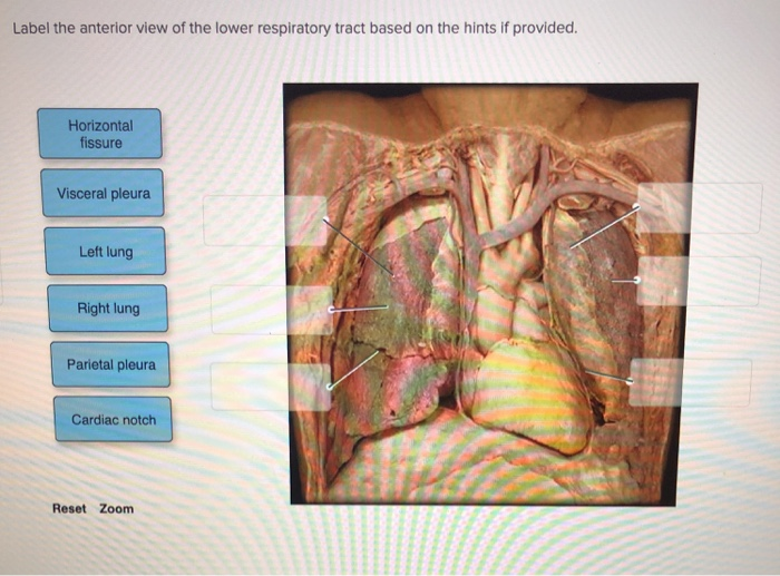 Solved Label the anterior view of the lower respiratory