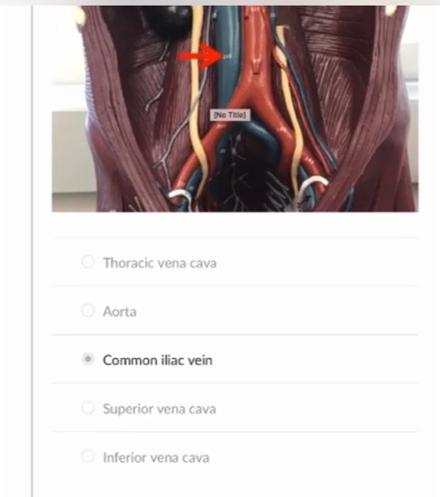 Solved Thoracic vena cava Aorta Common iliac vein [No Title] | Chegg.com