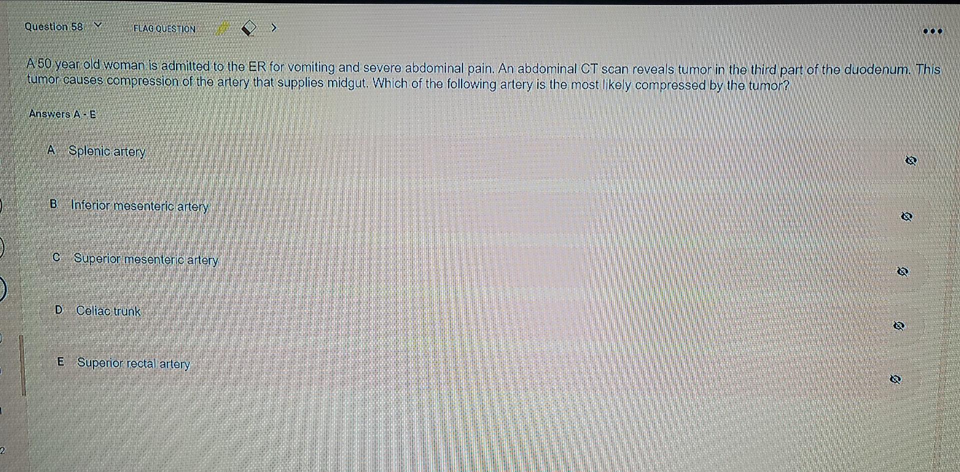 Solved Question 58 V FLAG QUESTION > OO A 50 year old woman | Chegg.com