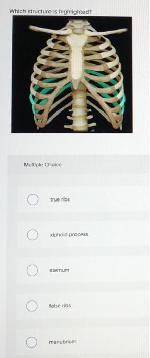 Solved Which structure is highlighted? Multiple Choice true | Chegg.com