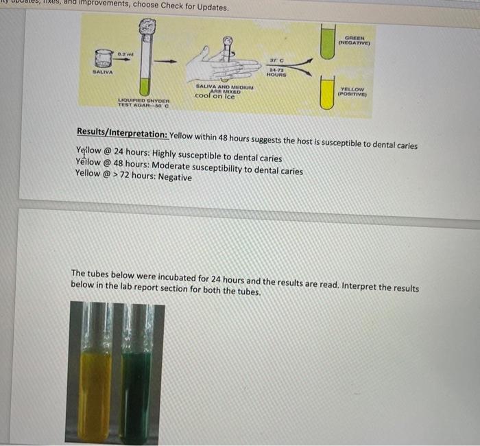 Solved SNYDER TEST Caries Susceptibility Testing(Mouth