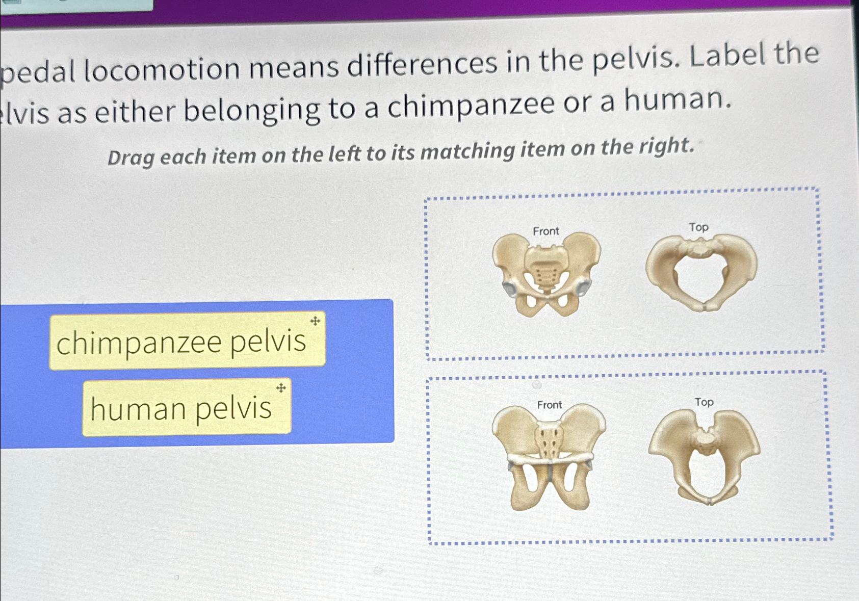 Solved pedal means differences in the pelvis.