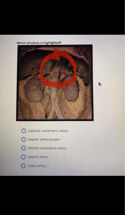 Which structure is highlighted? O superior mesenteric artery O hepatic artery proper interior mesenteric artery O splenic art
