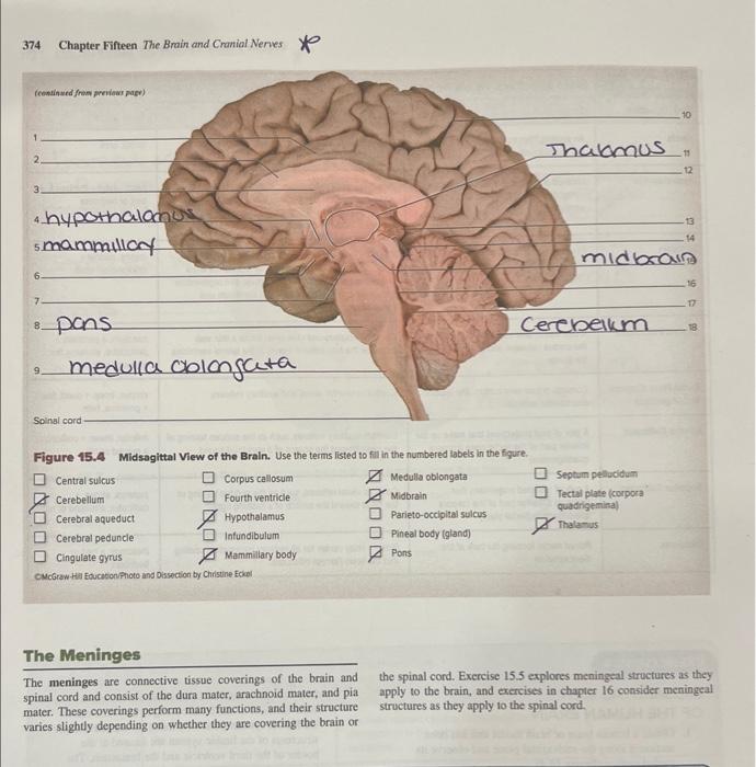 Solved 374 Chapter Fifteen The Brain and Cranial Neries y | Chegg.com