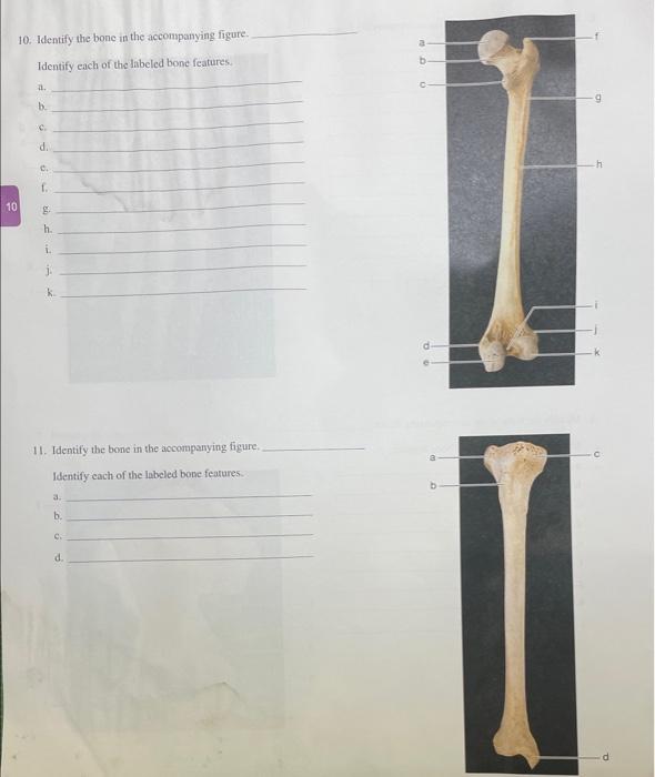 Solved 8. Identify each of the bones in the accompanying | Chegg.com