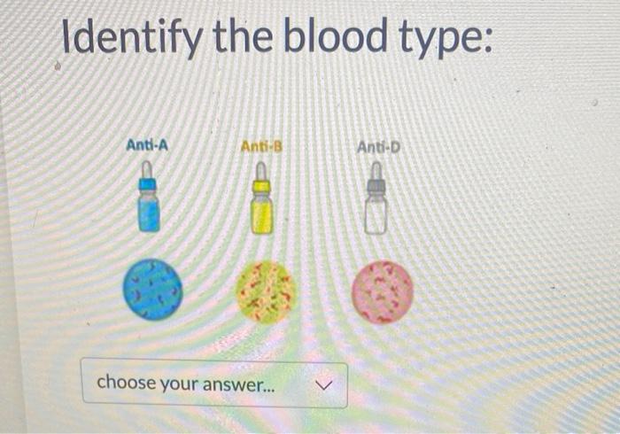 Identify the blood type: