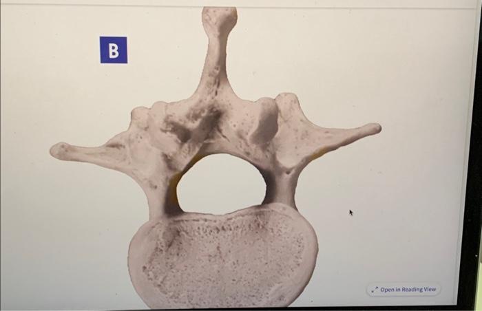 Solved bs Identify each of the following vertebrae in | Chegg.com