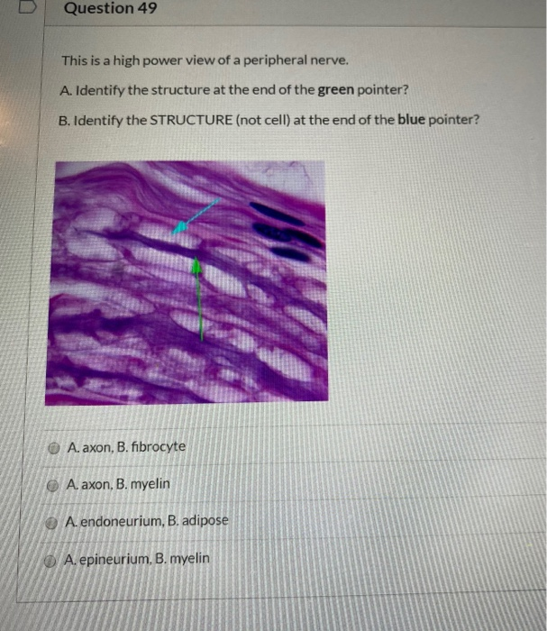 Solved Question 45 1 pts The central nervous system (CNS) is | Chegg.com