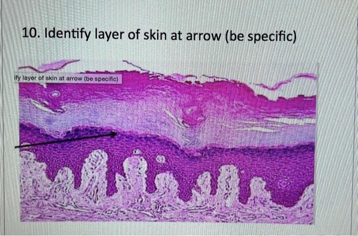 Solved 10. Identify layer of skin at arrow (be | Chegg.com