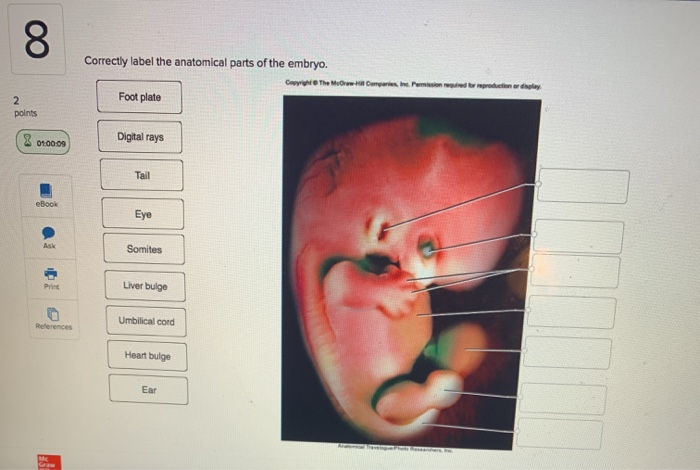 Solved: 00 Correctly Label The Anatomical Parts Of The Emb... | Chegg.com