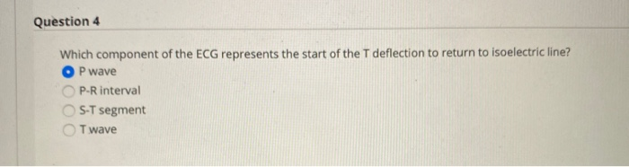 Solved Question 4 Which component of the ECG represents the | Chegg.com