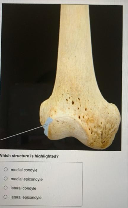 Solved Which structure is highlighted? O acromial end O | Chegg.com