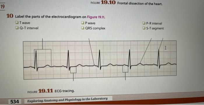 Solved Figure 19.10 Frontal Dissection Of The Heart. 10 