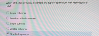 Solved Which of the following is an example of a type of | Chegg.com