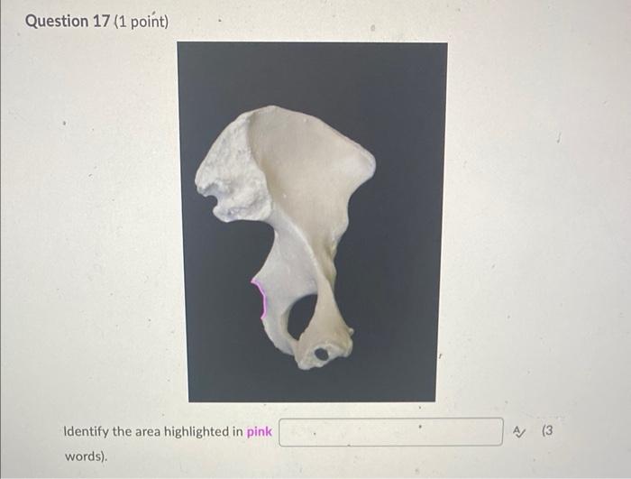 Solved Question 17 (1 point) Identify the area highlighted | Chegg.com