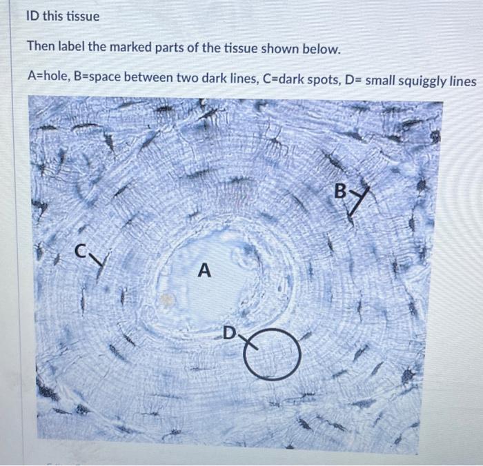 ID this tissue
Then label the marked parts of the tissue shown below.
\( \mathrm{A}= \) hole, \( \mathrm{B}= \) space between