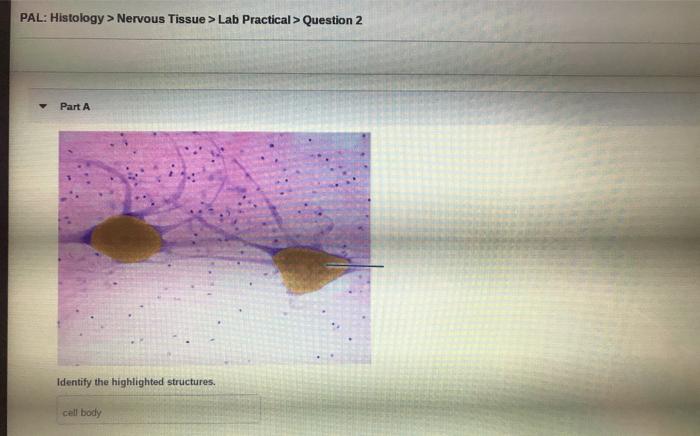 Solved PAL: Histology > Nervous Tissue > Lab Practical > | Chegg.com