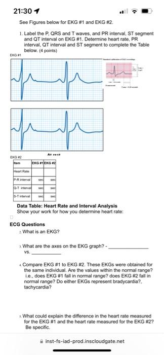 Solved See Figures Below For EKG #1 And EKG #2. 1. Label The | Chegg.com