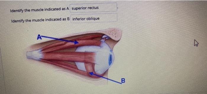 Solved Which of the following muscles extends and laterally | Chegg.com