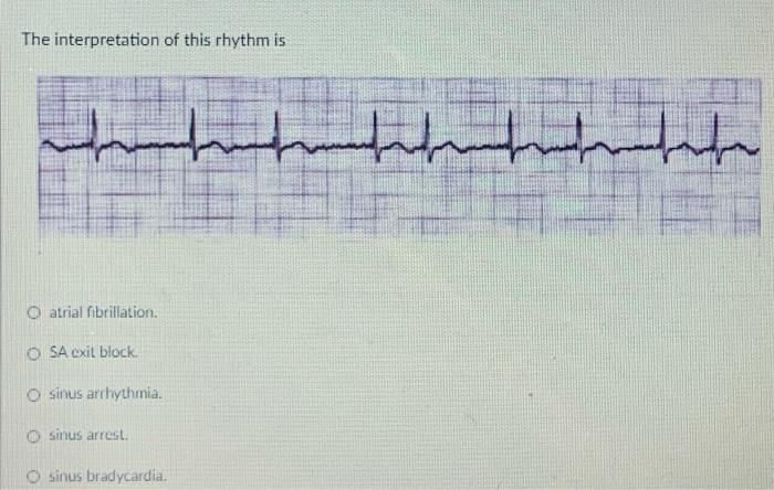 Solved The Interpretation Of This Rhythm Is Msha O Atrial Chegg Com