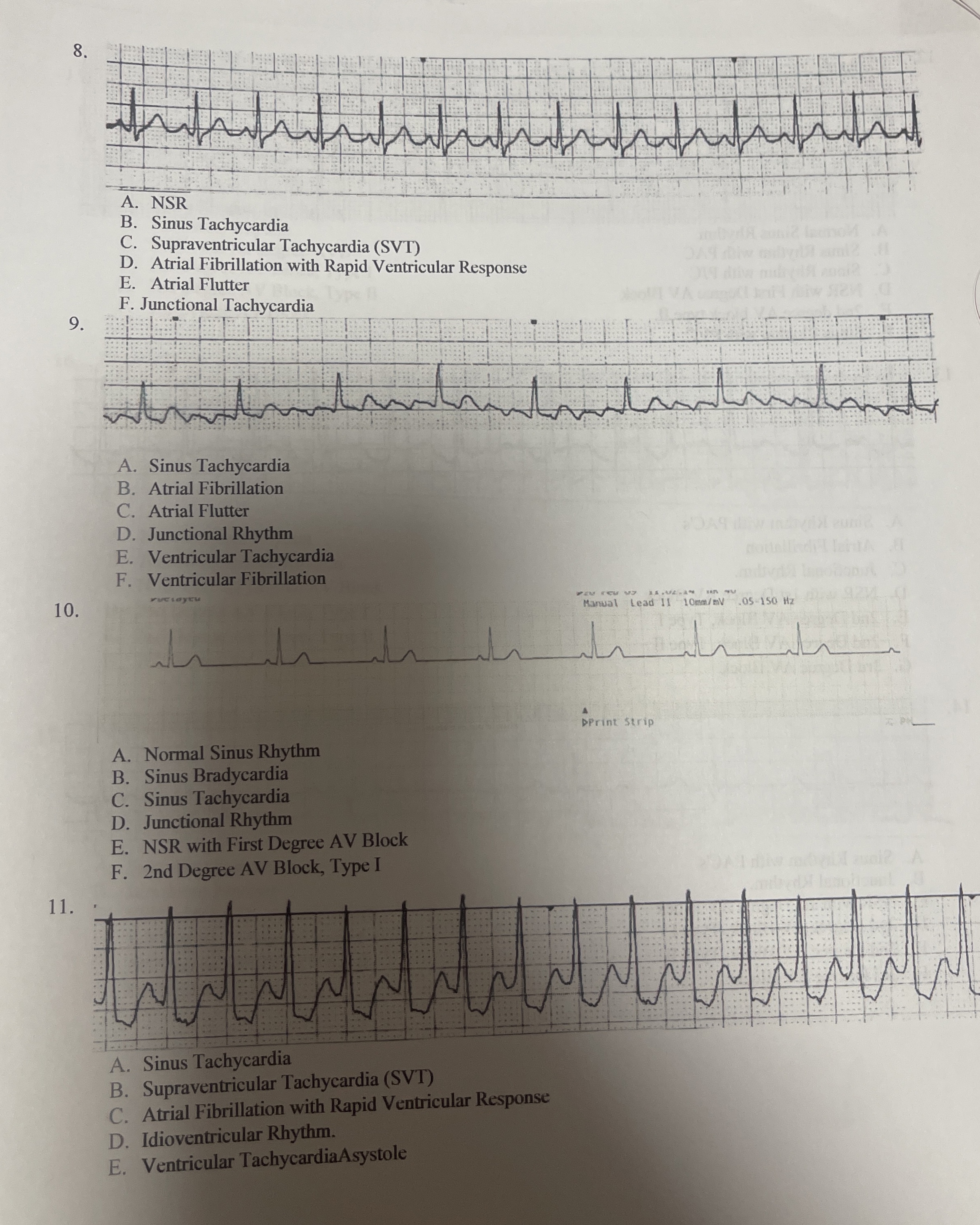Solved B. ﻿Sinus TachycardiaC. ﻿Supraventricular Tachycardia | Chegg.com