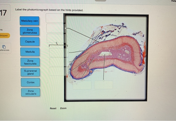 Solved Help Label the photomicrograph based on the hints | Chegg.com