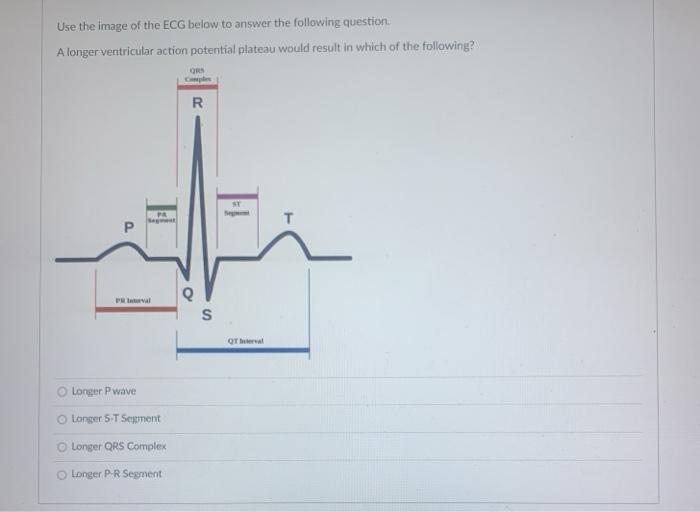 Solved Use the image of the ECG below to answer the | Chegg.com