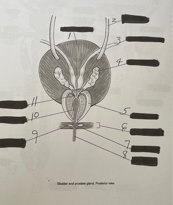 Solved 1. Bulbourethral gland (Cowper's gland) 2. Corpus