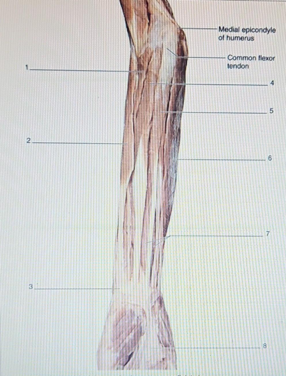 Solved label the right anterior forearm | Chegg.com