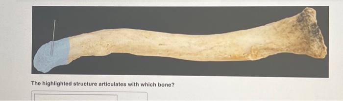Solved The highlighted structure articulates with which | Chegg.com