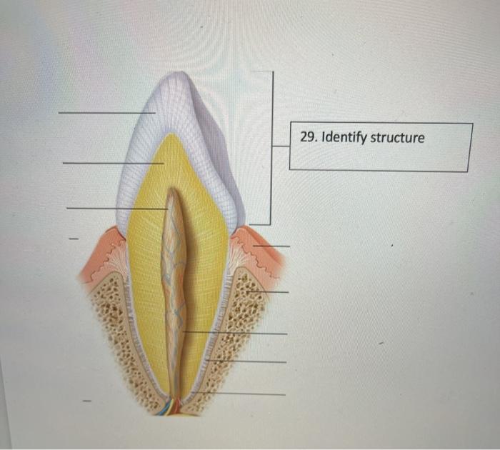 Solved 29. Identify structure 30. Function of tooth 31. | Chegg.com