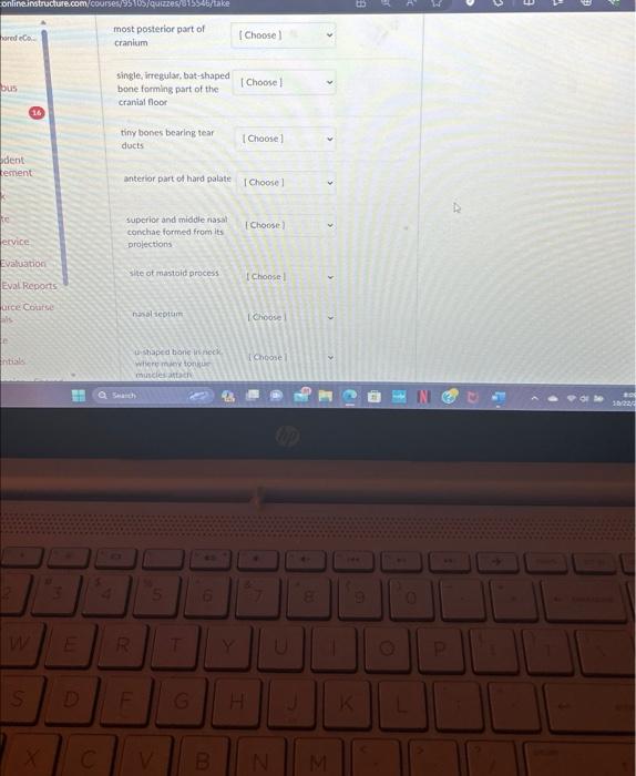 Solved Match the following bones with the correct names. | Chegg.com