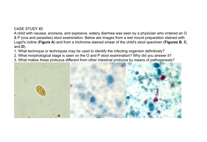 Case Study 2 A Child With Nausea Anorexia And Chegg Com