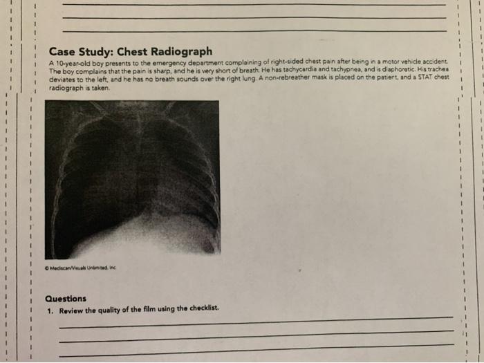 Case Study: Chest Radiograph A 10-year-old boy presents to the emergency department complaining of right-sided chest pain aft