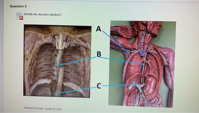 Solved Question 3 Identify the structure labeled A B С | Chegg.com